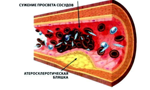 Почему немеют руки при беременности?